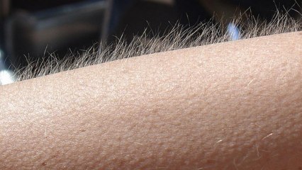 If music gives you chills, your brain is special