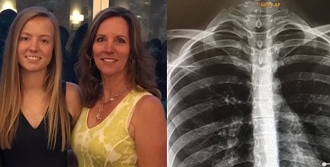 Her parents were furious when they spotted an unexpected surprise on her x-ray