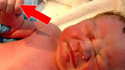 This baby was born holding something unbelievable in his hand