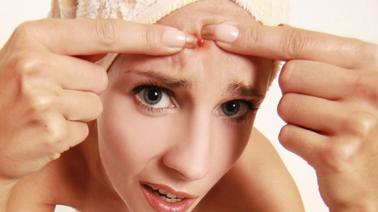 Welche Lebensmittel verursachen Pickel? Das sind die Übeltäter!