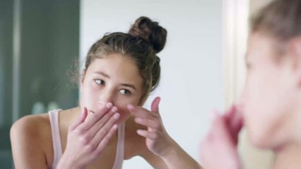 Face Mapping: Die Stelle eines Pickels verrät, mit welchem Organ etwas nicht stimmt