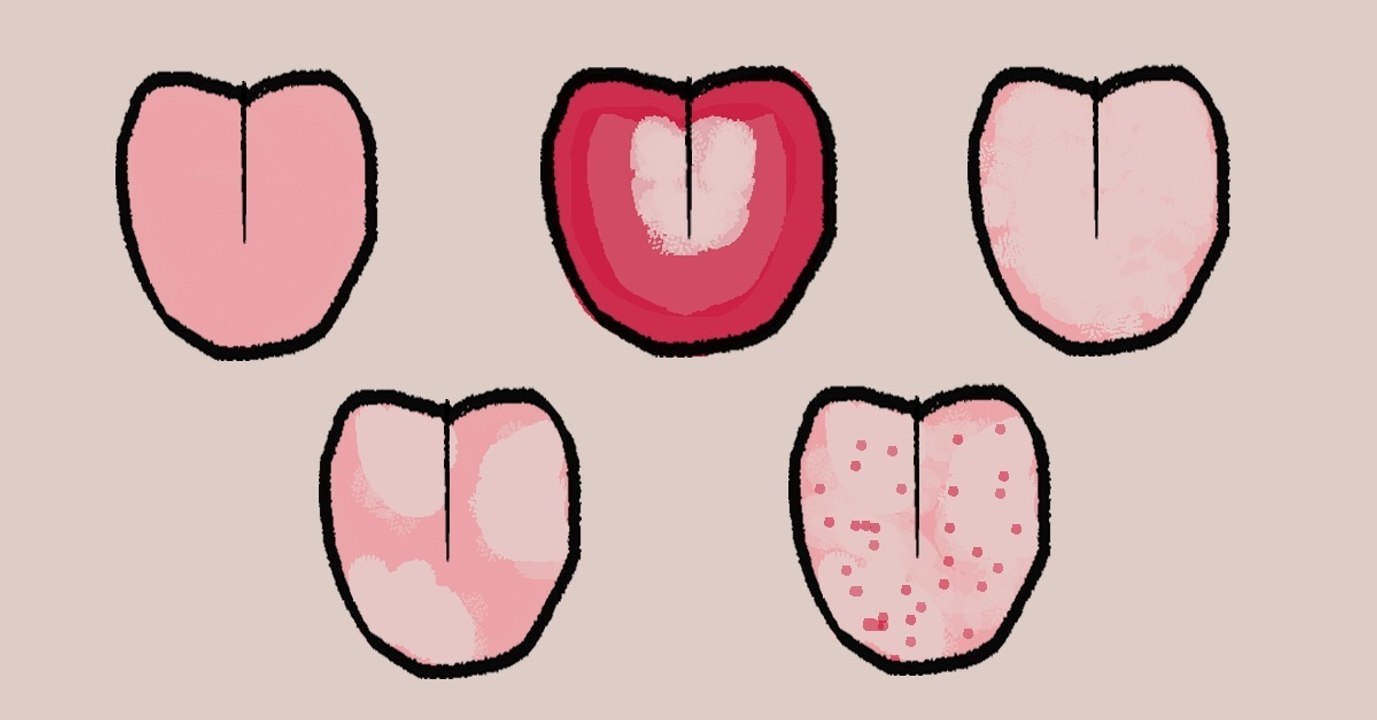 Das verrät die Farbe deiner Zunge über deine Gesundheit