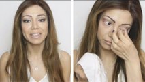 When she removed her makeup to reveal her condition, her fans were left speechless