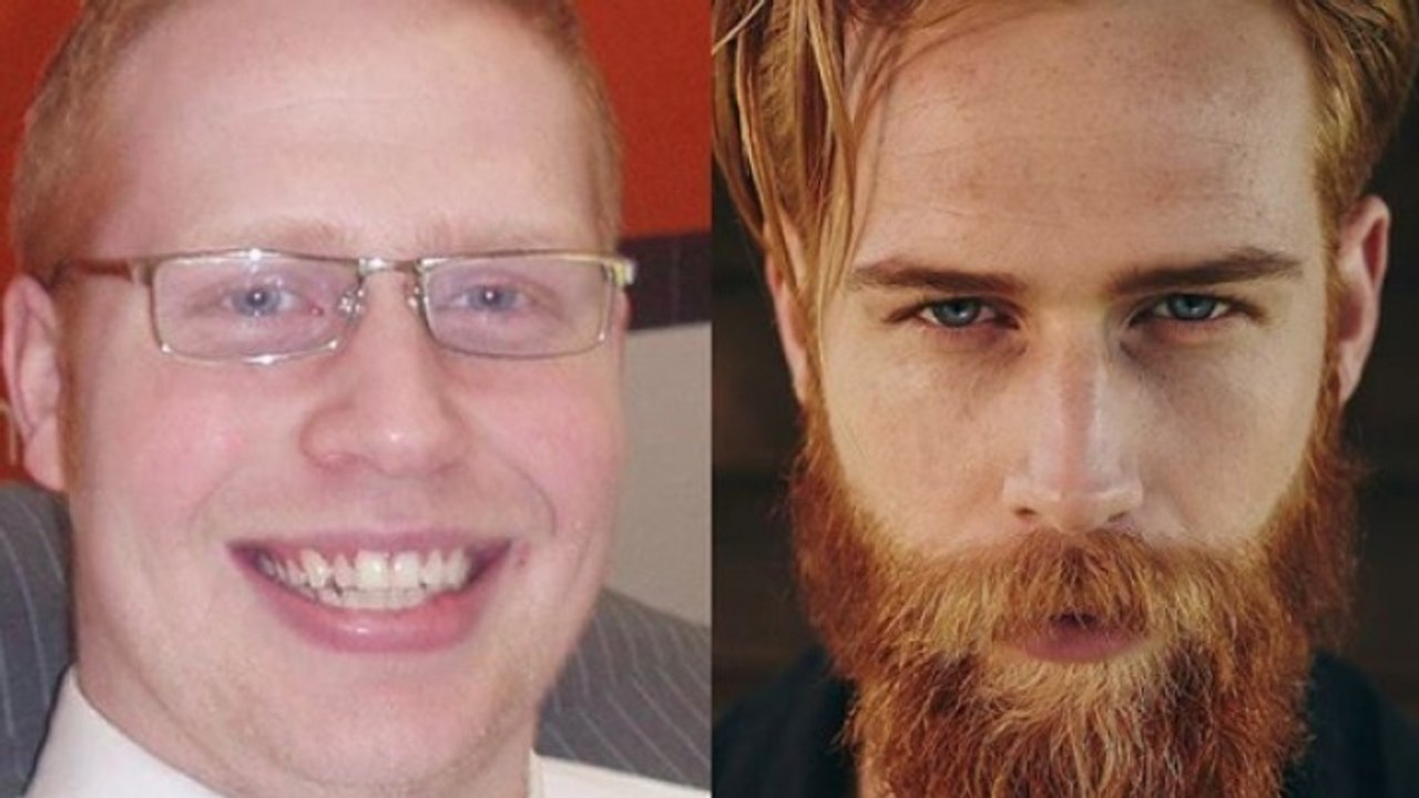 Mann leidet wegen seines Aussehens unter Komplexen: Seine Verwandlung ist beeindruckend!