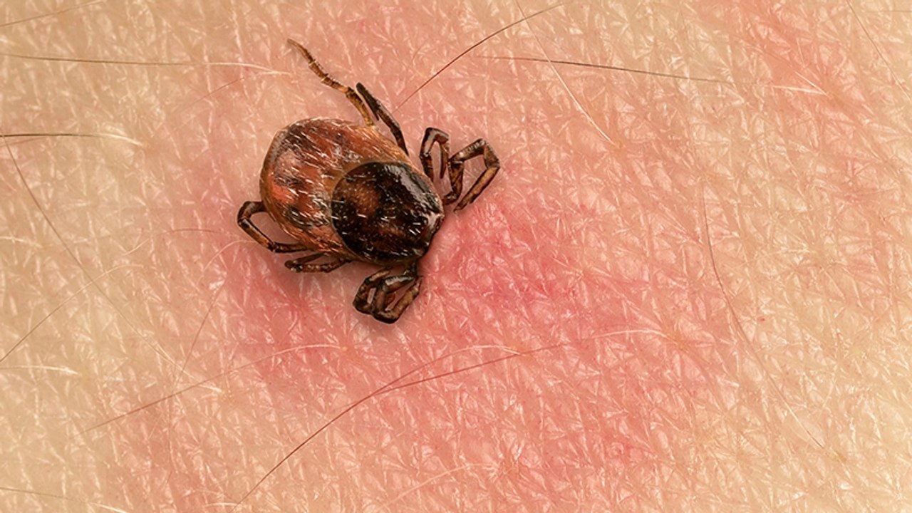 Zeckenbiss: So reagierst du bei genau richtig