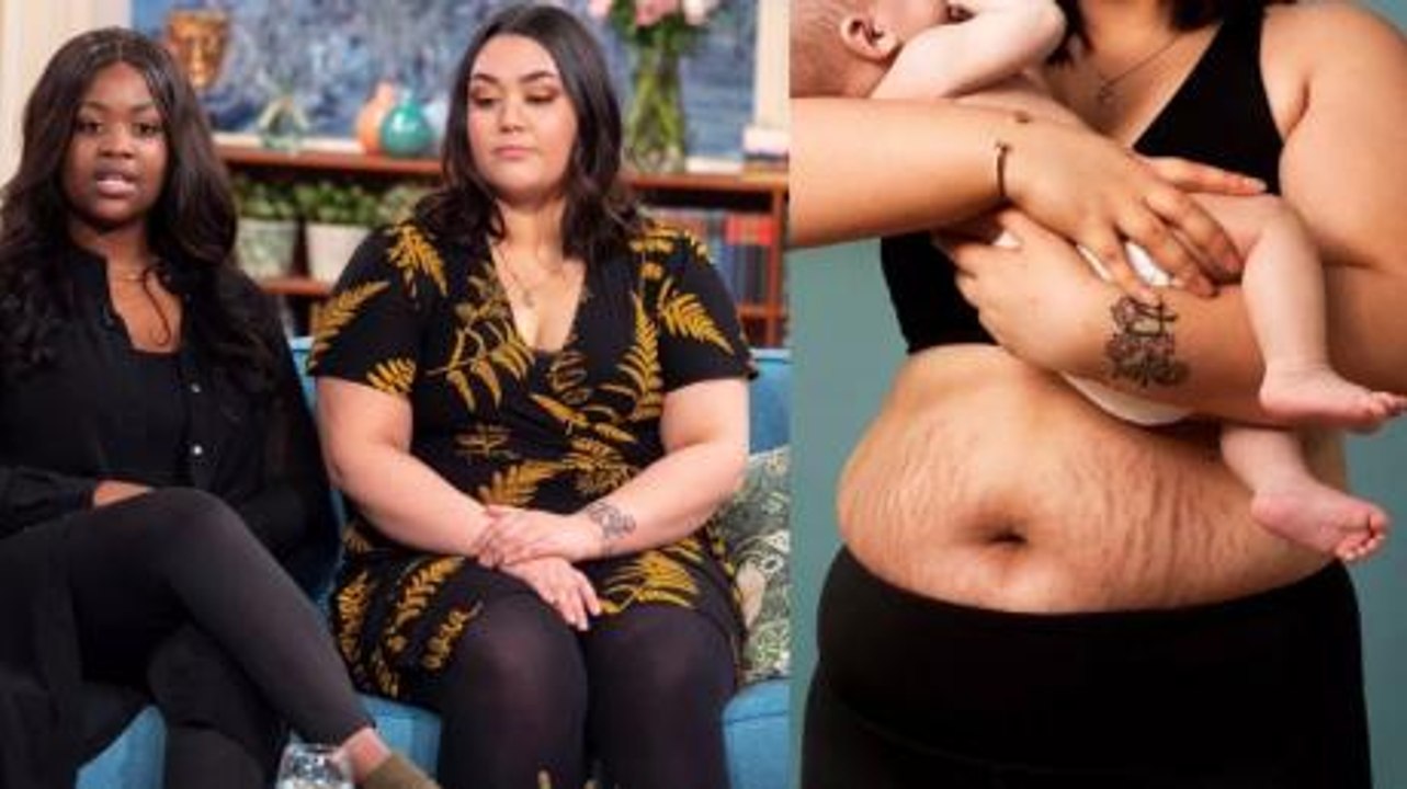 These new mums displayed their stretch marks to challenge people to love their bodies