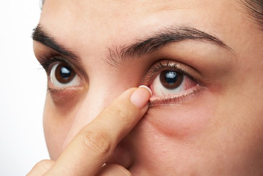 Gesundheit am Auge erkennen: So deutest du die Symptome richtig