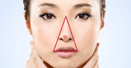 "Bermudadreieck" im Gesicht: In dieser Zone solltest du nie einen Pickel ausdrücken