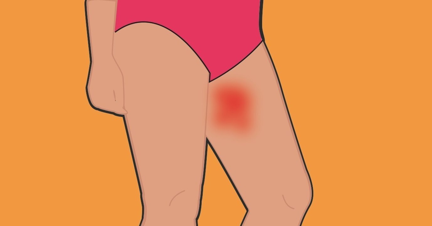 Sommerplage: so verhinderst du lästige hautreizungen an den innenschenkeln
