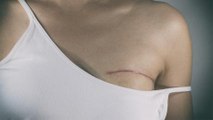A Young Mother Had Her Breasts Removed, Then Doctors Realise Their Terrible Mistake