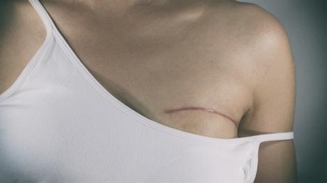 A Young Mother Had Her Breasts Removed, Then Doctors Realise Their Terrible Mistake