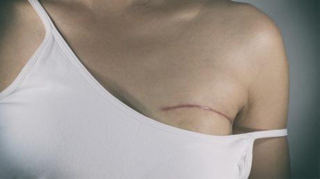 A Young Mother Had Her Breasts Removed, Then Doctors Realise Their Terrible Mistake