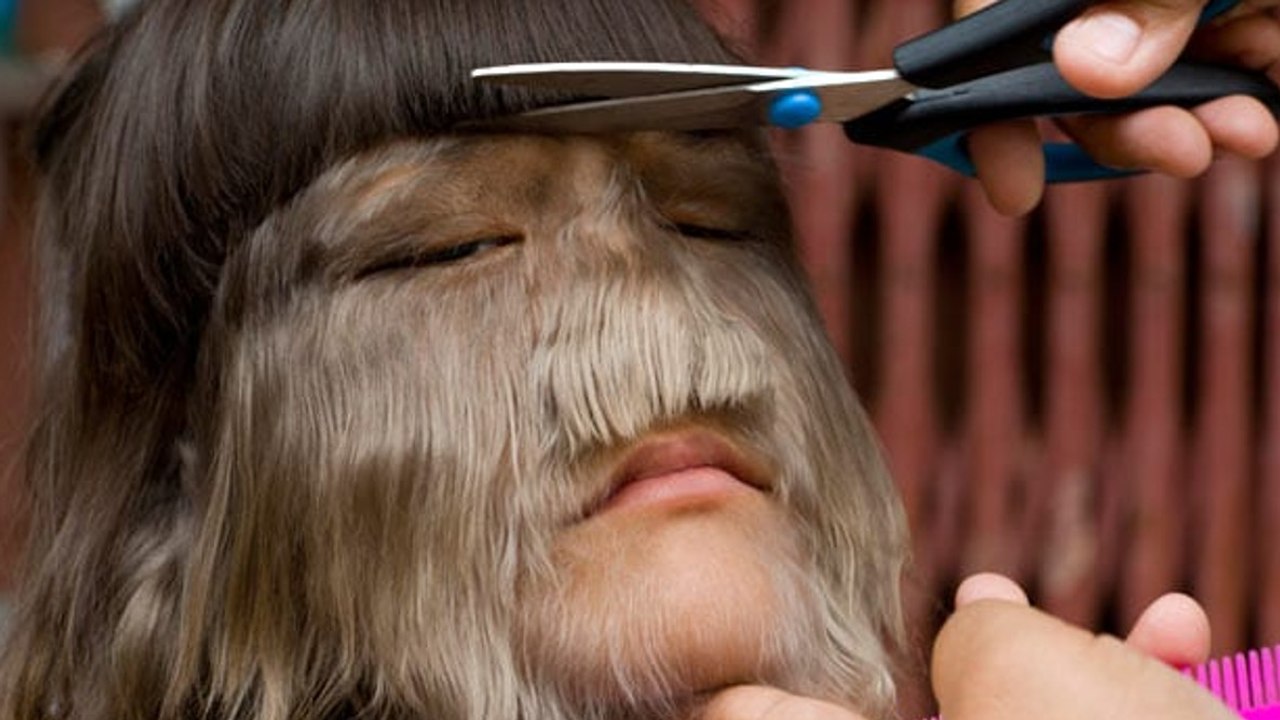 So sieht das 'haarigste Mädchen der Welt' heute als Jugendliche aus