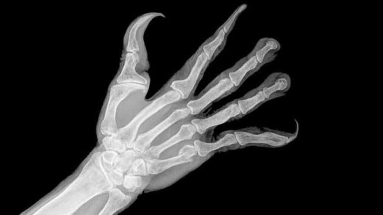 Weniger als ein Jahrzehnt: So verformen Smartphones jetzt schon unsere Hände