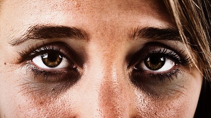 Eigentlich für andere Körperstelle: Diese Creme ist ein Wundermittel gegen Augenringe