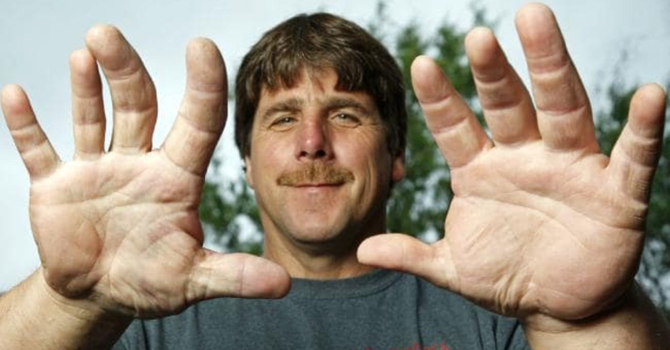 Menschlicher Popeye: Dieser Mann hat die größten Arme und Hände