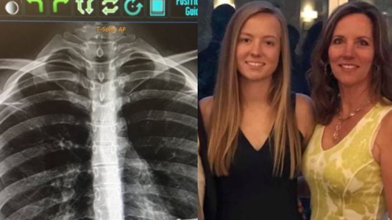 Eltern ahnen nichts: Röntgenbild ihrer Tochter bringt Geheimnis ans Licht