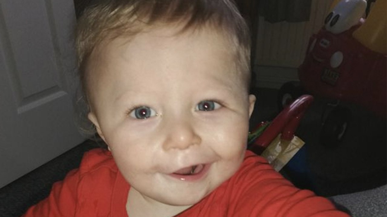 Mutter glaubt, ihr Kind hat einen Schlaganfall: Mithilfe eines Fotos erkennen Ärzt:innen das wahre Problem