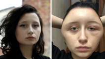 After Dyeing Her Hair She Realized Something Went Seriously Wrong - And It Almost Killed Her