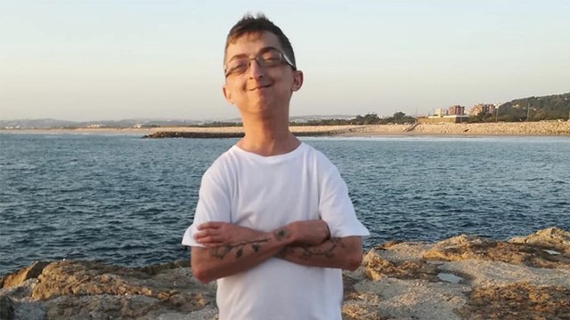 Seltene Krankheit: 20-Jähriger steckt im Körper eines Rentners