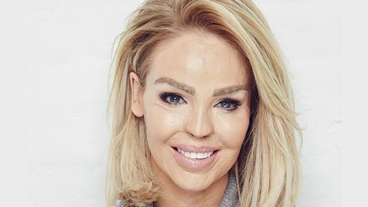 Ex überschüttet sie mit Säure: Dann wendet sie sich mit wichtiger Botschaft an die Öffentlichkeit