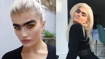 Model bekommt wegen Aussehen Morddrohungen