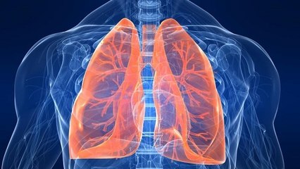 Pneumonie : symptômes, contagion, traitement, définition, de quoi s'agit-il ?