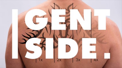 Tattoo-Entfernung: Die wichtigsten Informationen zur Laserprozedur