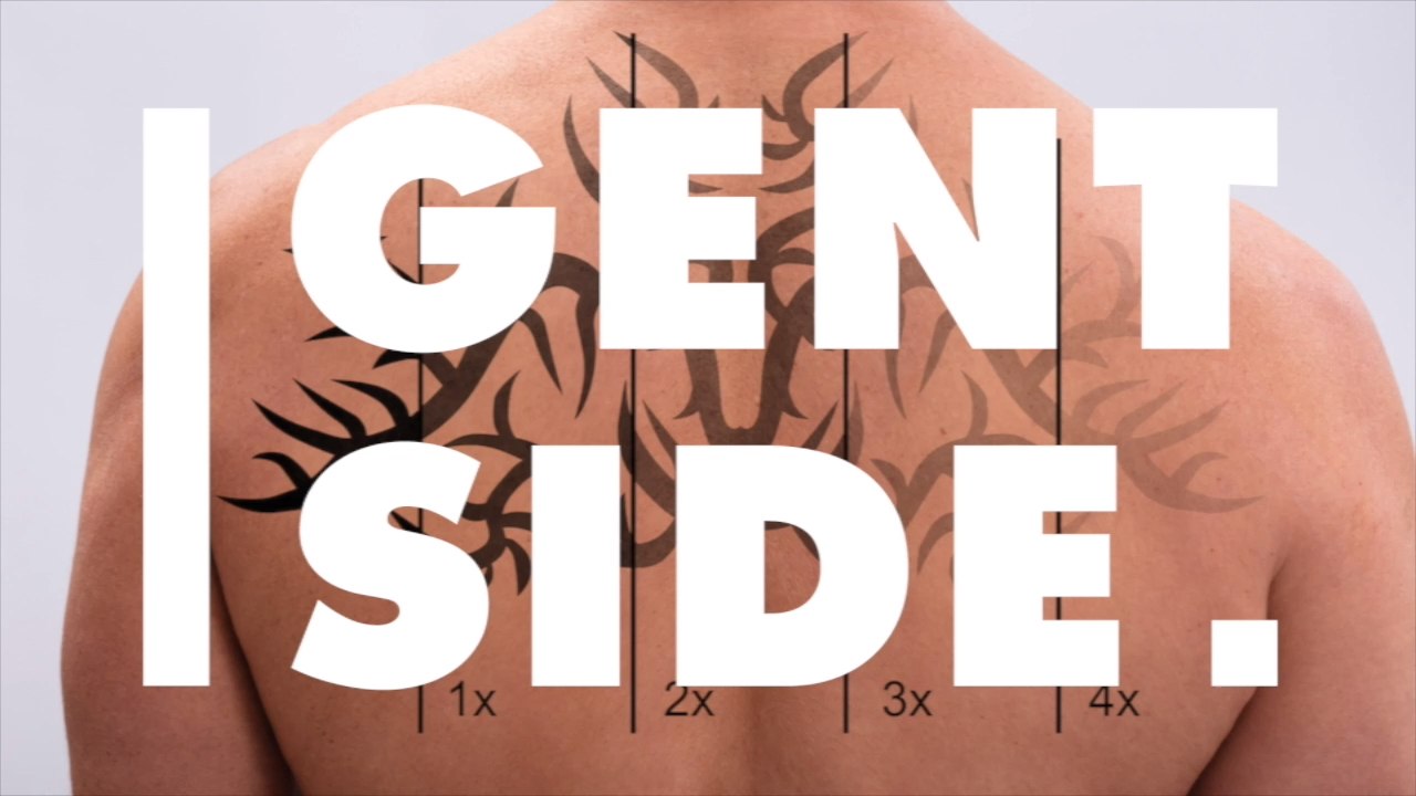 Tattoo-Entfernung: Die wichtigsten Informationen zur Laserprozedur