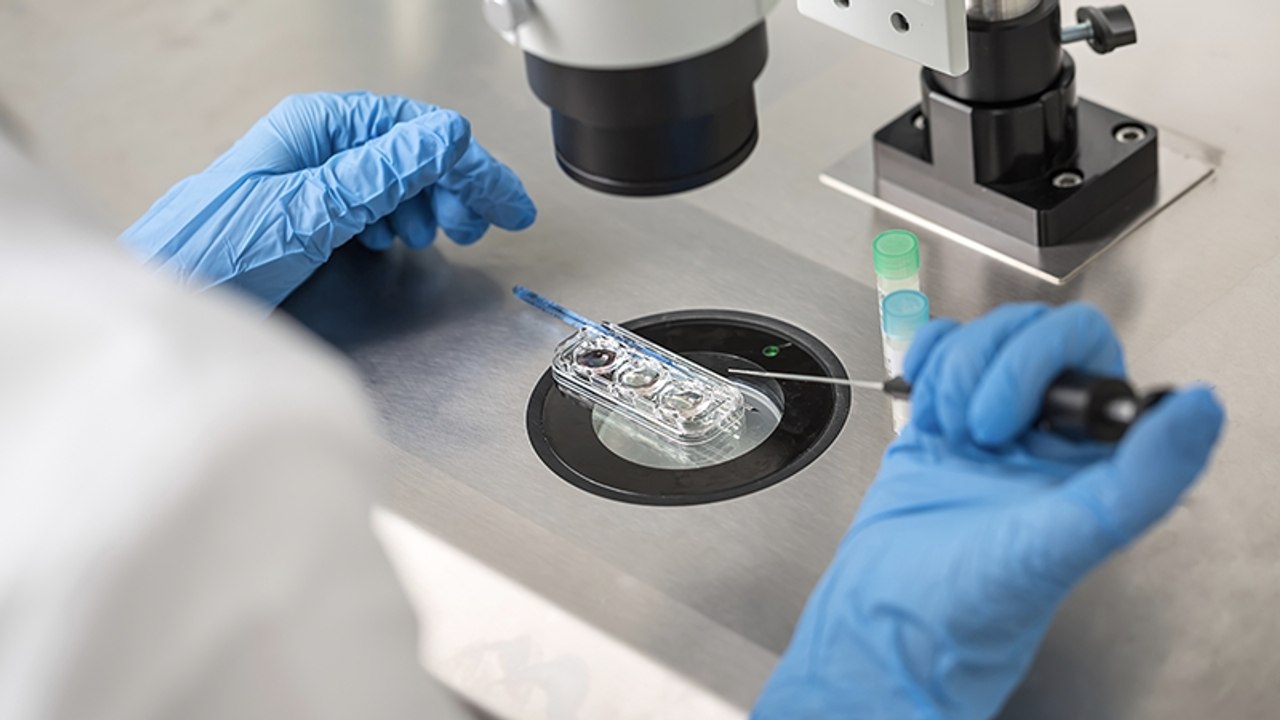 Vor künstlicher Befruchtung entdecken Ärzte etwas Ungewöhnliches in ihrer Eizelle