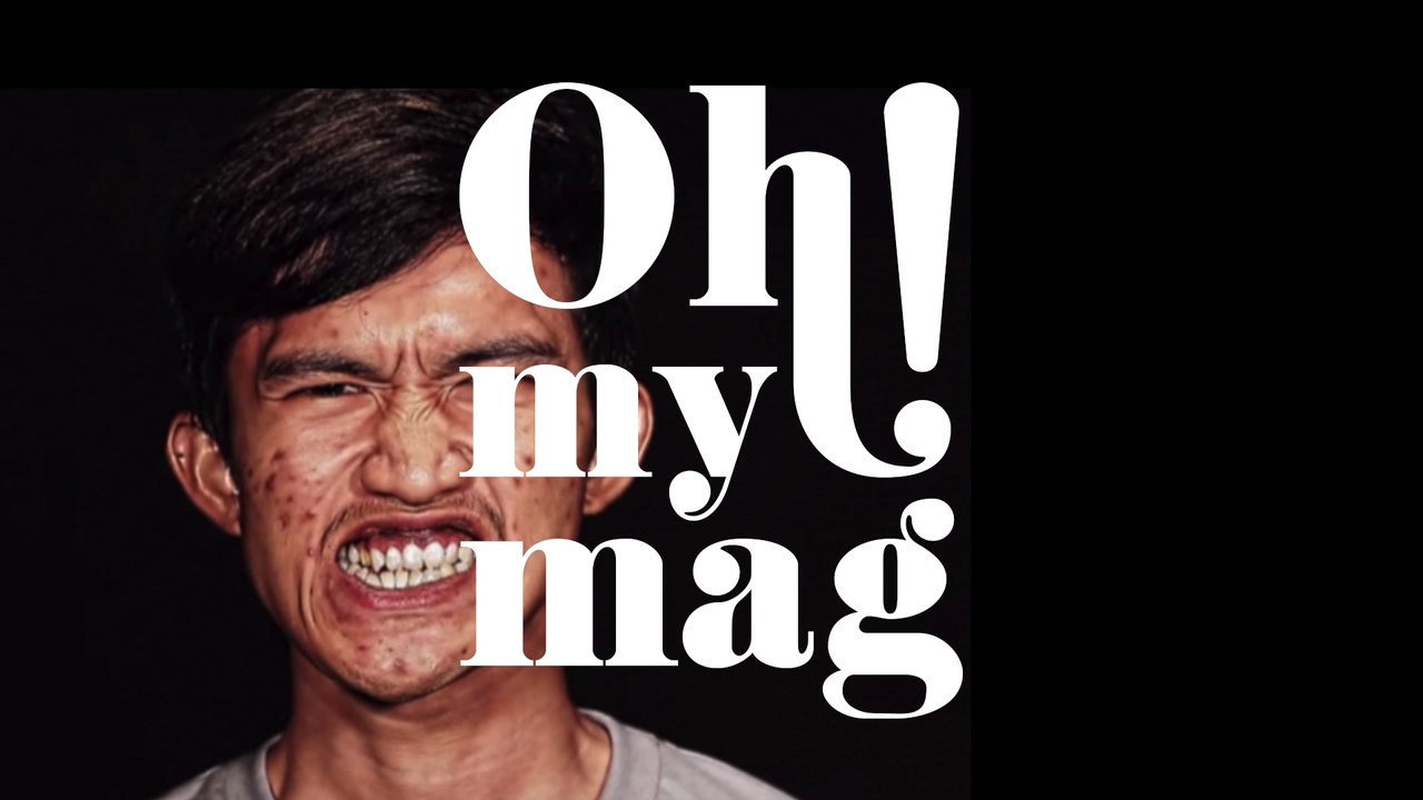 Nach Gesichts-OP in TV-Show: Mutter erkennt ihren Sohn kaum wieder