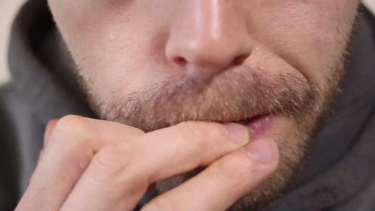 Nägelkauen: Frau bekommt es mit der Angst zu tun, als sie merkt, was es mit ihrem Körper macht