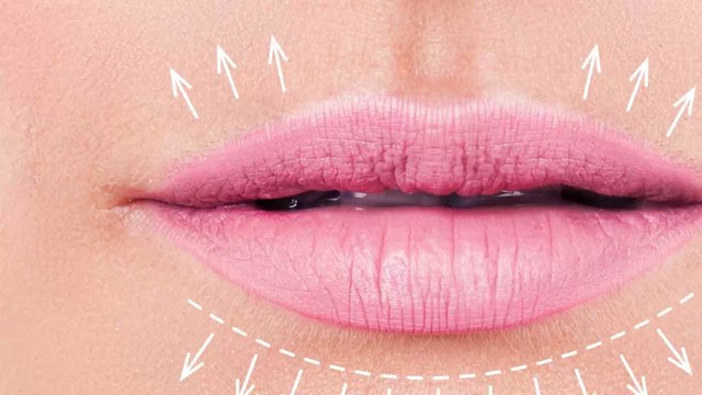 Cheap fillers caused this mum's lips to explode 5 times!