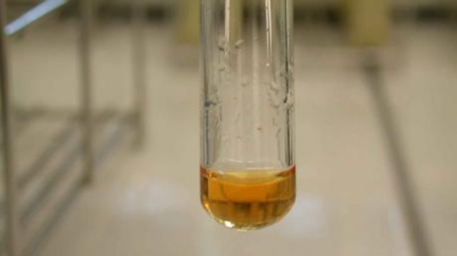 Urée : définition, rôle, comment analyser les résultats ?