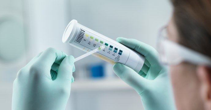 Protéinurie : définition, rôle, comment analyser les résultats ?