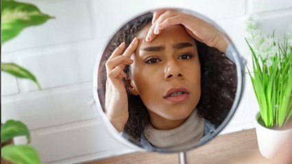 "Ganzes Gesicht entstellt": Frau will Mitesser entfernen, doch das bereut sie schnell