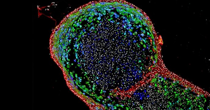 Des chercheurs ont fait pousser un mini-œsophage en laboratoire