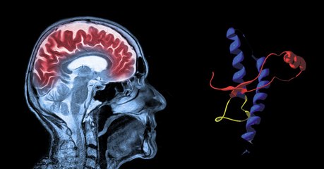 Les chercheurs synthétisent la protéine tueuse du prion en laboratoire