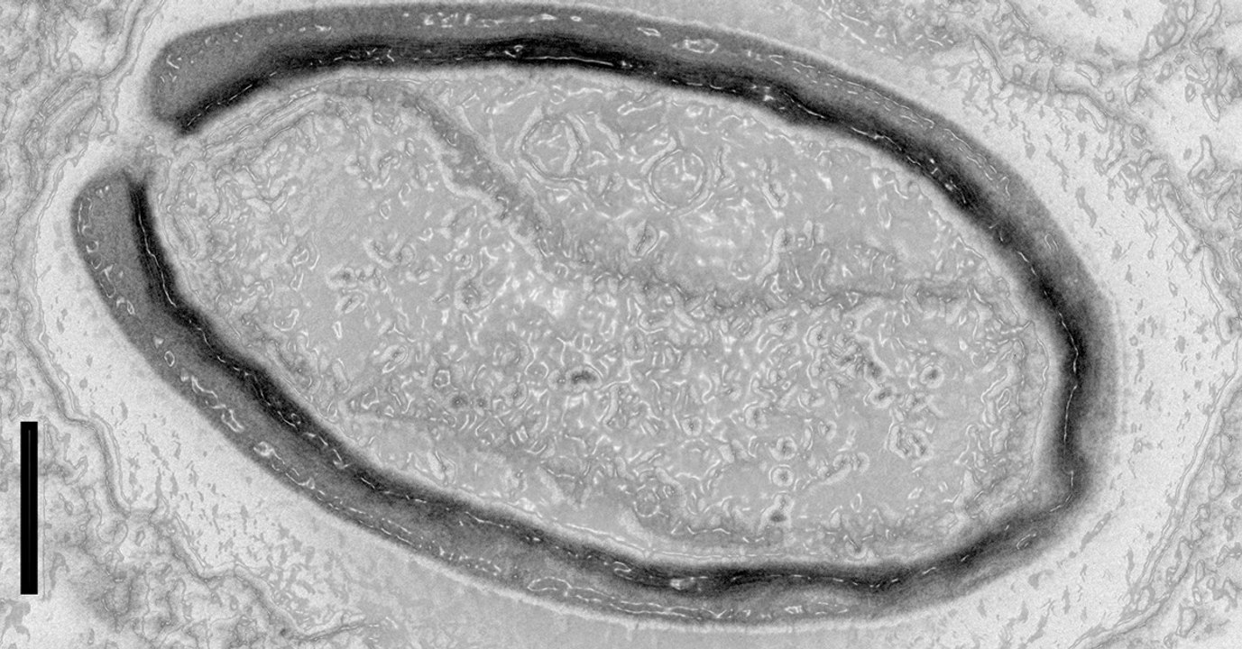 Les pandoravirus, ces virus géants qui forment...