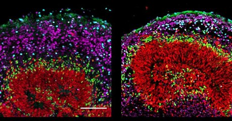 Des scientifiques ont réussi à faire pousser des cerveaux de primates en laboratoire