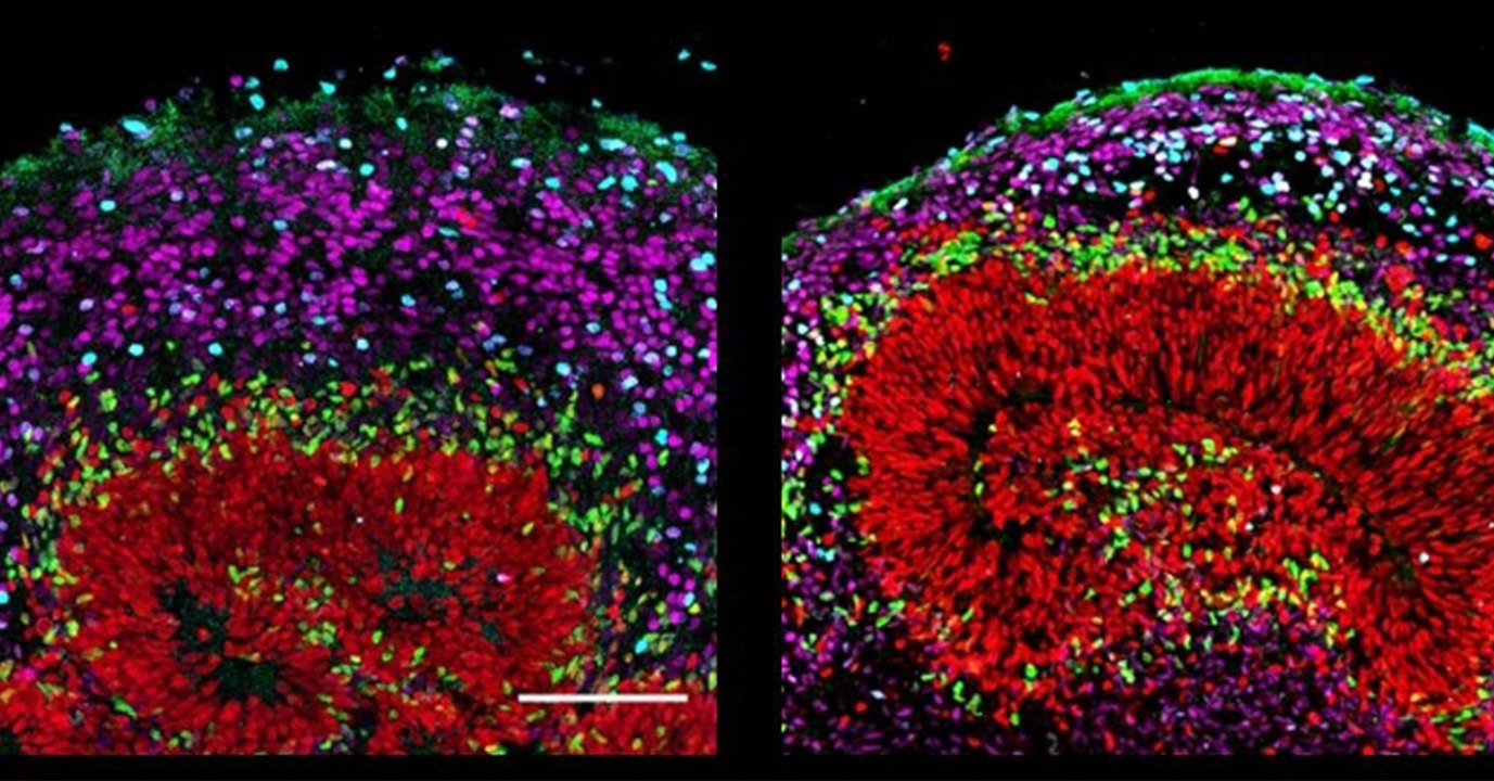 Des scientifiques ont réussi à faire pousser des cerveaux de primates en laboratoire