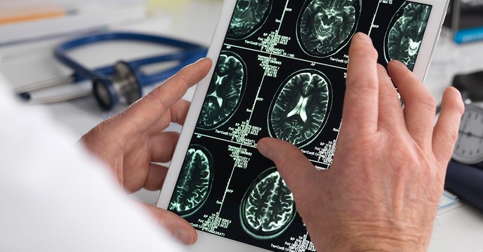 Un cerveau plus grand vous rend-il plus intelligent ? Les scientifiques tentent de répondre