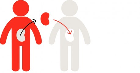 Don d’organes post mortem : comment ça fonctionne ?