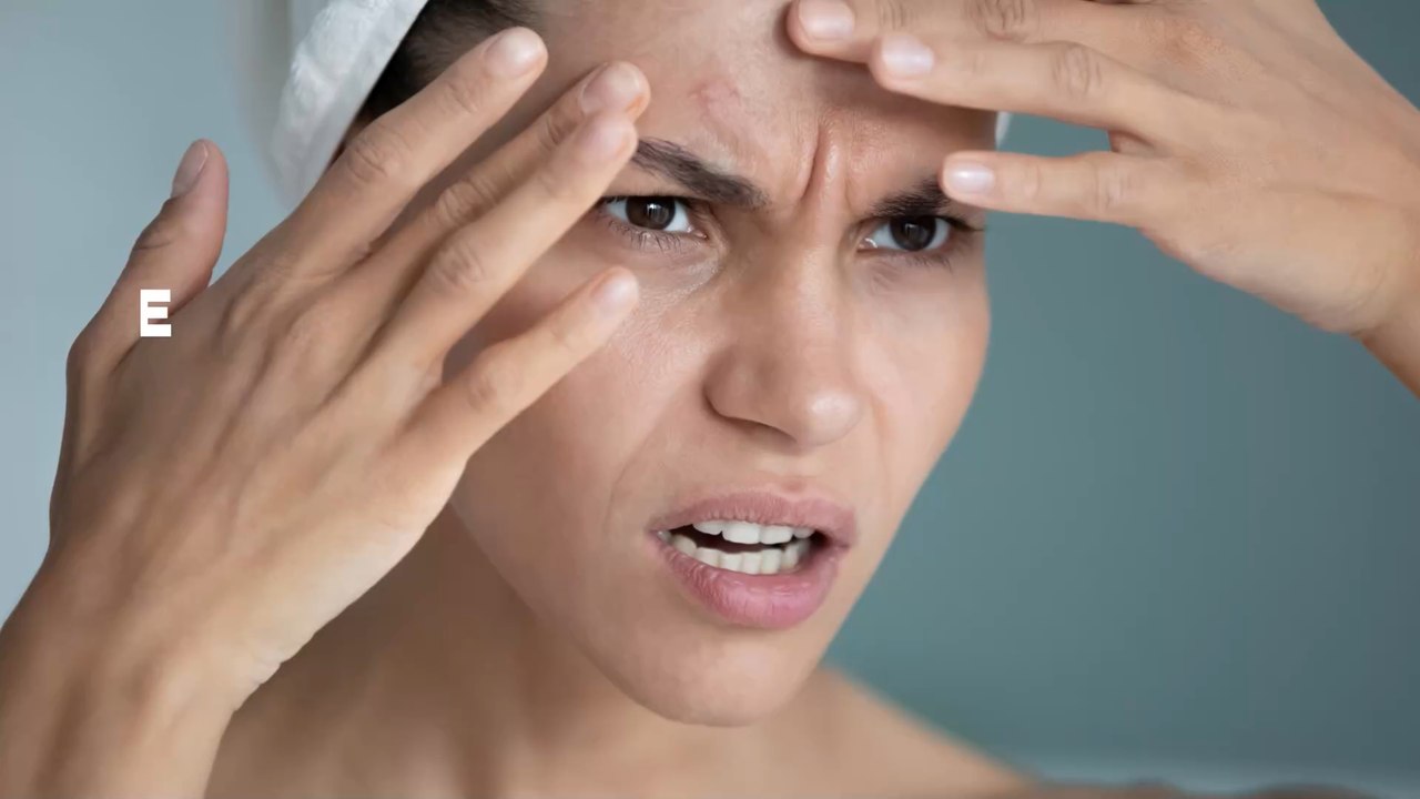 Acne: Does drinking water really help your skin?
