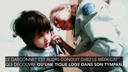 Son oreille bourdonne, il avait en fait une tique dans le tympan