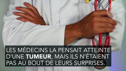 La tumeur au cerveau de cette femme était en fait un ver vivant