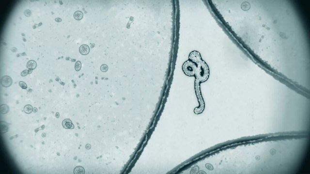 Lassa fever: Two cases of Ebola-like virus that causes vaginal bleeding has been detected