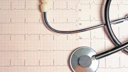 Tachycardie ventriculaire : définition, symptômes, traitement, ablation, qu'est-ce que c'est ?