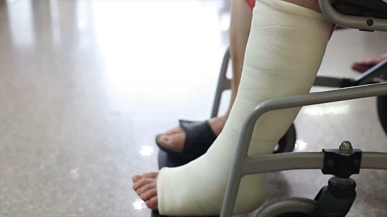 Calcanéum : définition, fracture, douleur, traitement... tout savoir sur cette partie du pied