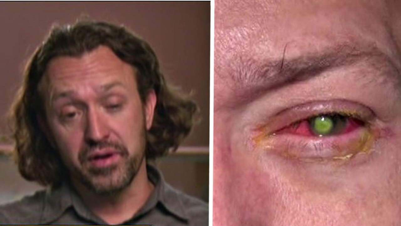 Cet homme est devenu aveugle à cause d'un petit oubli. Et ça pourrait arriver à tout le monde !